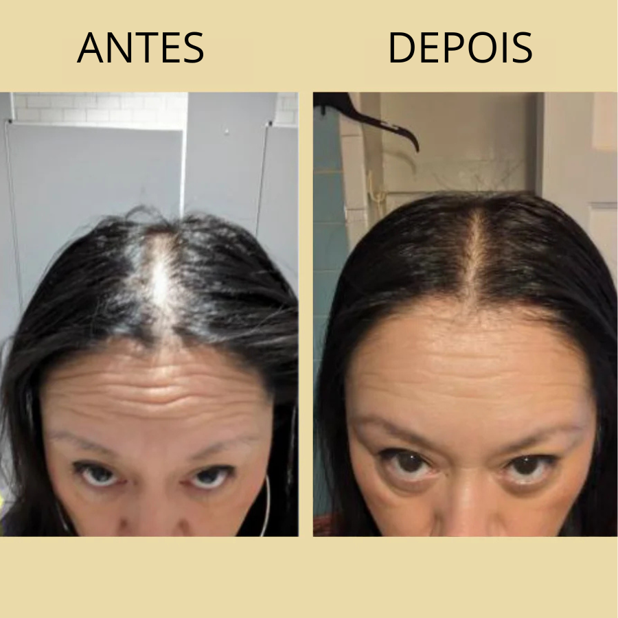 BOTANIL – CRESCIMENTO CAPILAR – RESULTADOS VISÍVEIS EM 3 SEMANAS